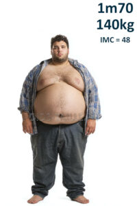 Homme 1m70 140kg